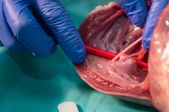 Anatomy Nights: par sirdslietām Valentīndienā